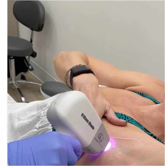 Laser Hair Reduction by Radiance Skin and Laser